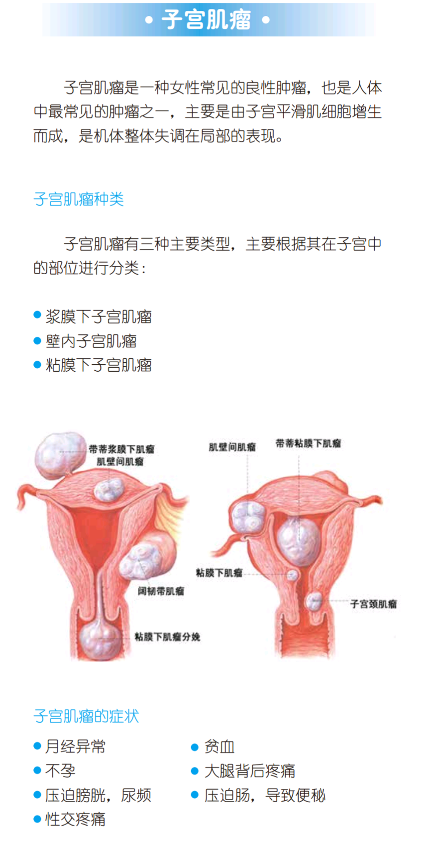 子宫肌瘤最新治疗技术解析，观点与立场阐述